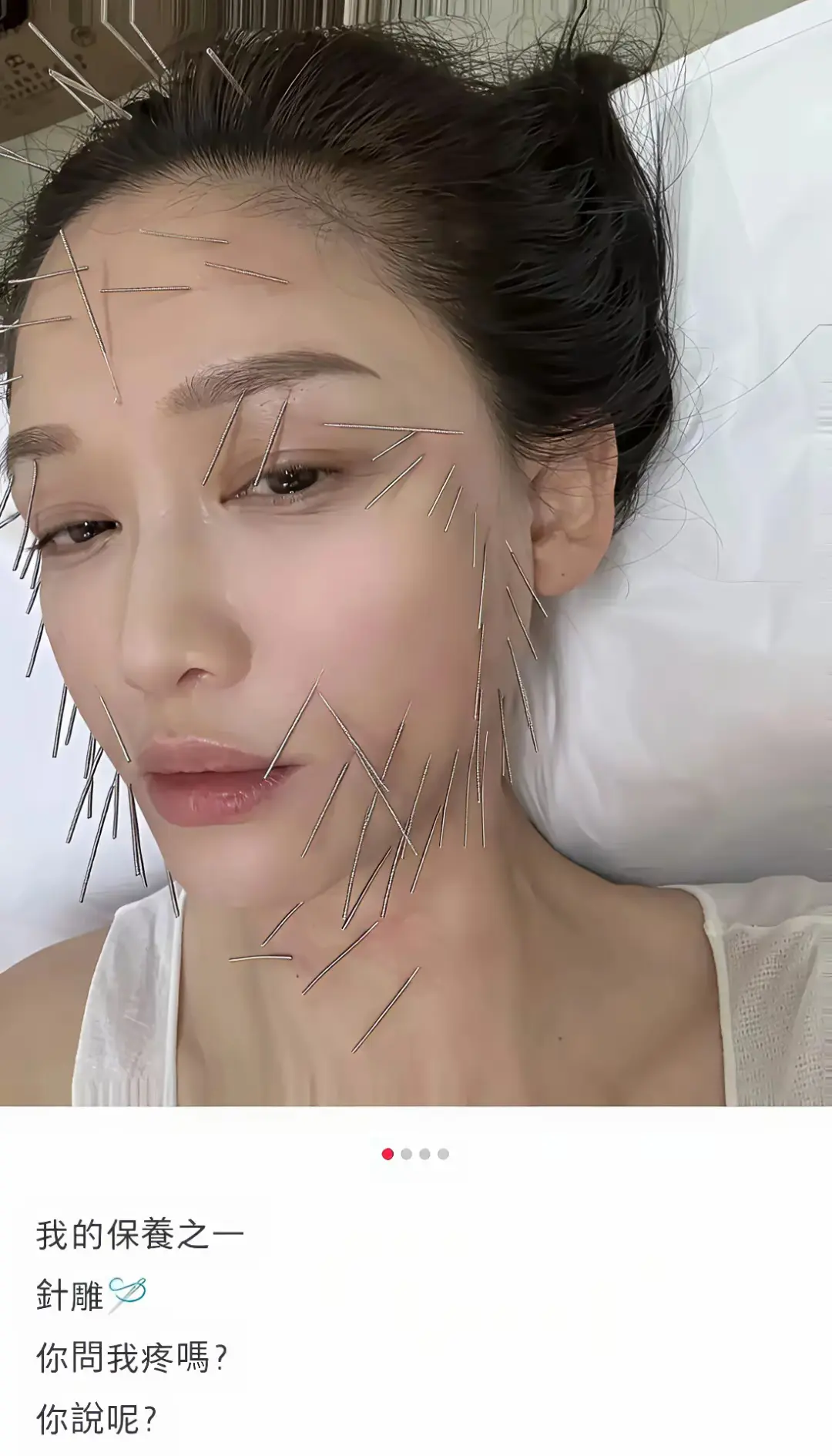 这只是开胃菜，女明星为了自己的美丽真的是拼了。