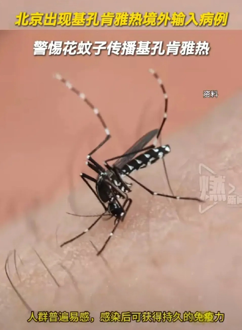 基孔肯雅热，我国第一次爆发！划重点，第一次爆发，没有疫苗！但是国外有疫苗～