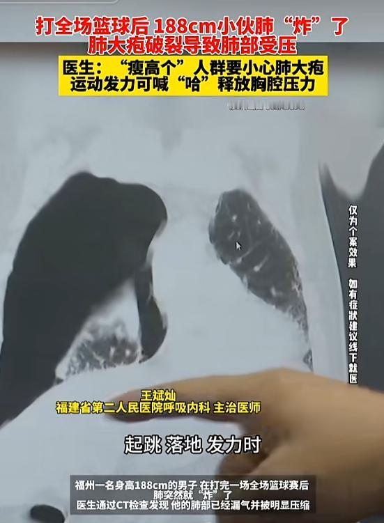 8月21日报道，福建福州，一男子打完一场常规的篮球赛后，无撞击、无摔倒却感觉胸口