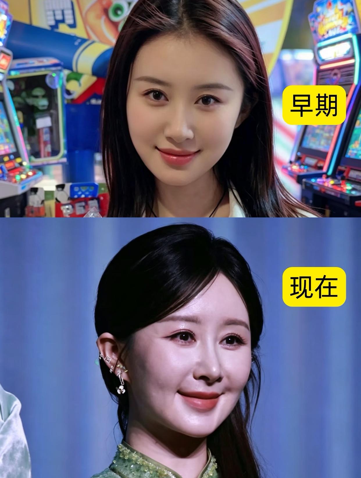 这真的太明显了，但这次想说的是突然理解了女明星整容，女为悦己者容，更何况这