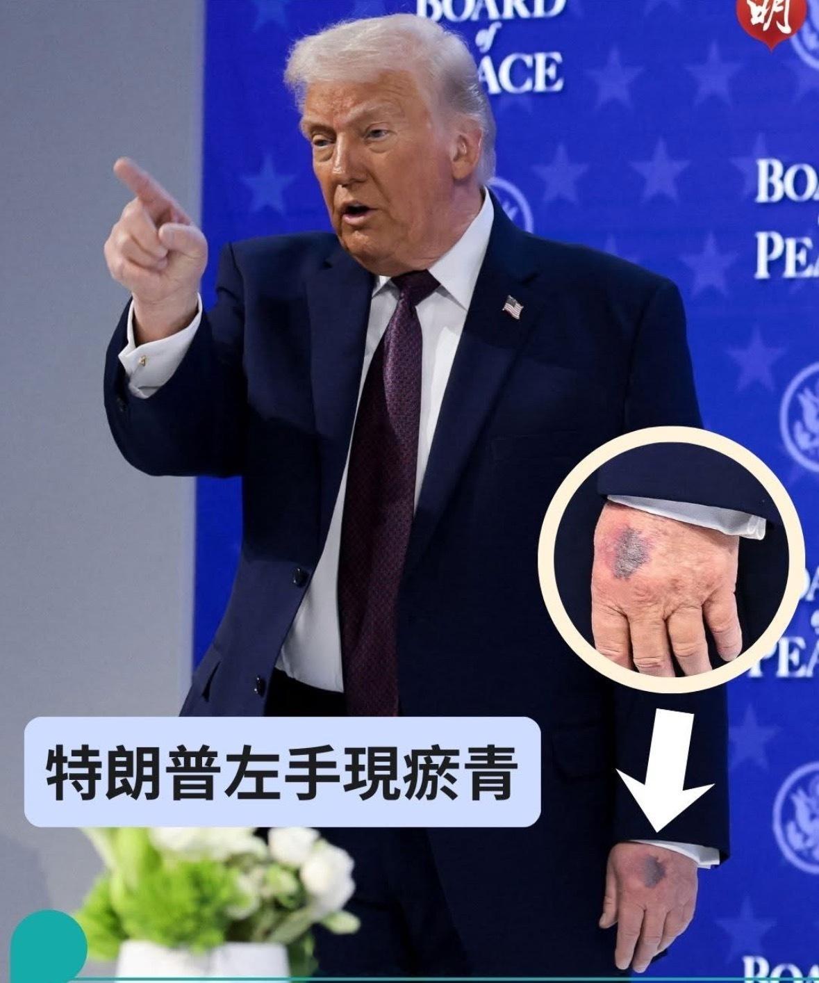 被那口子揍了吗家庭不幸啊