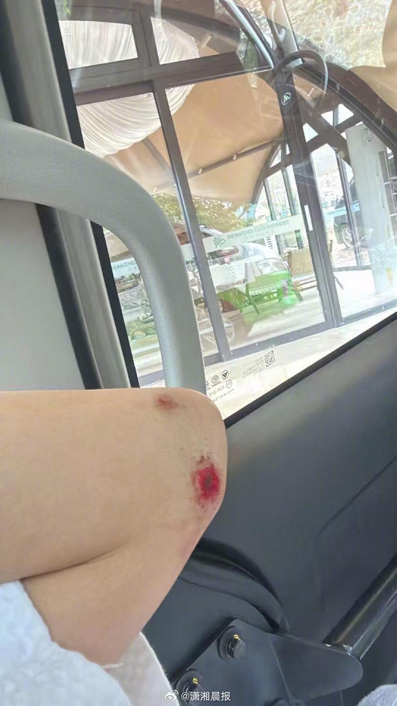 【#仙本那险遭性侵女子自述事件经过#】#仙本那遇袭女子逃入树林一度绝望#9月19