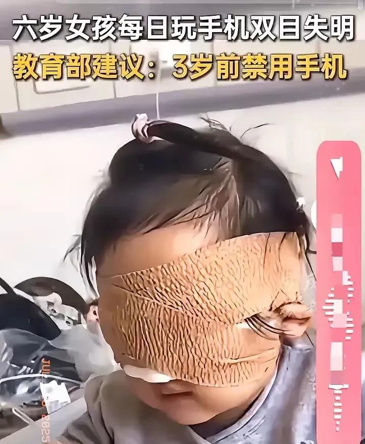 孩子玩手机，导致失明！难怪幼儿园，那么多戴眼镜的孩子。难怪小学生，那么多戴眼
