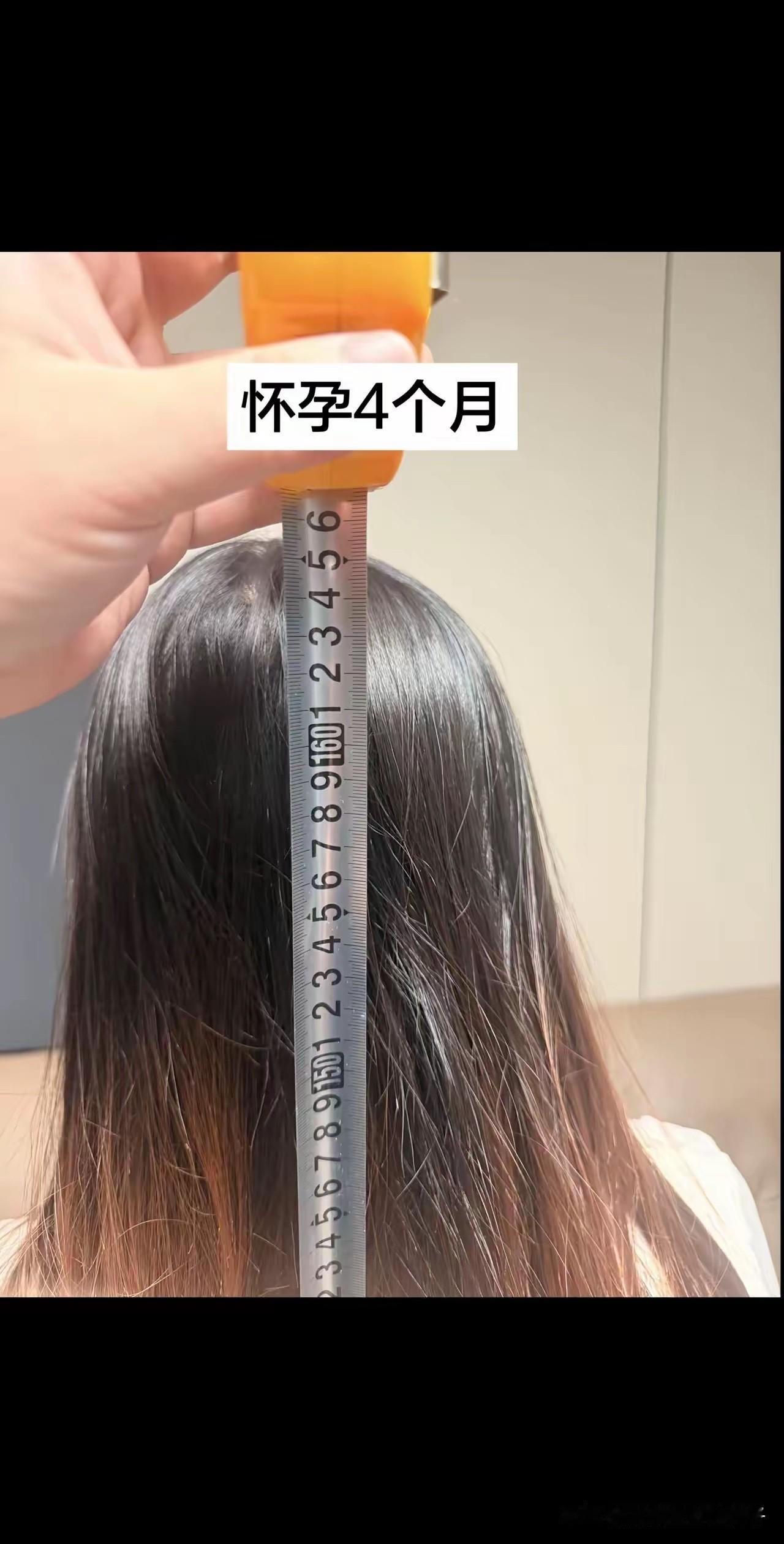 不懂就问，这是什么原因长高的？