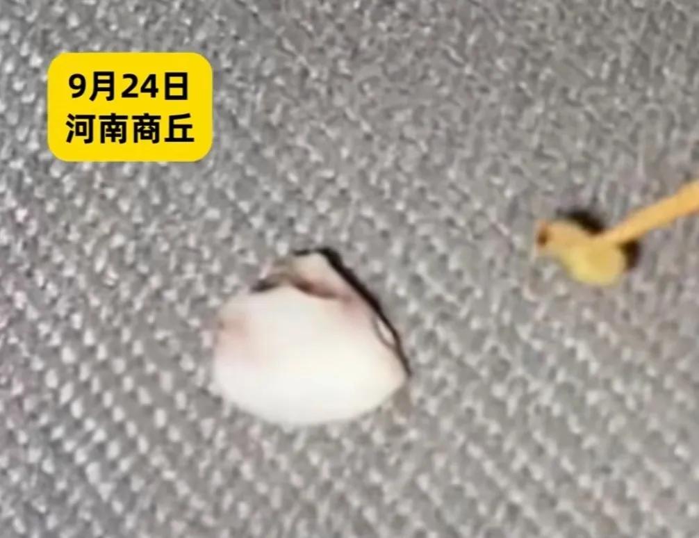 牙缝里“长虫”了？别慌，那真不是牙虫！继泉州一位大叔洗牙时，医生从他后槽牙缝
