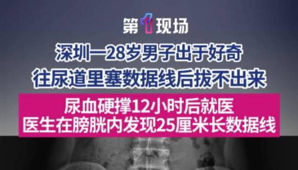 很多人一时猎奇容易做出荒唐举动，深圳一名28岁男子就因为盲目好奇，给自己惹出