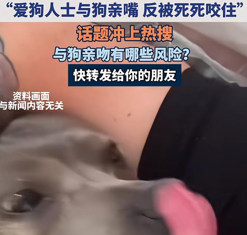 有位女子就是这么亲了一下自家狗，结果狗突然翻脸，一口死死咬住她不放。旁边人急得直