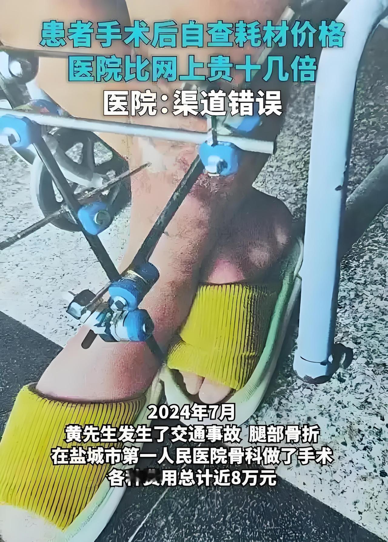 医疗必须改革！集采都降74%了，这耗材还翻13倍卖？中间的钱被谁吃了？