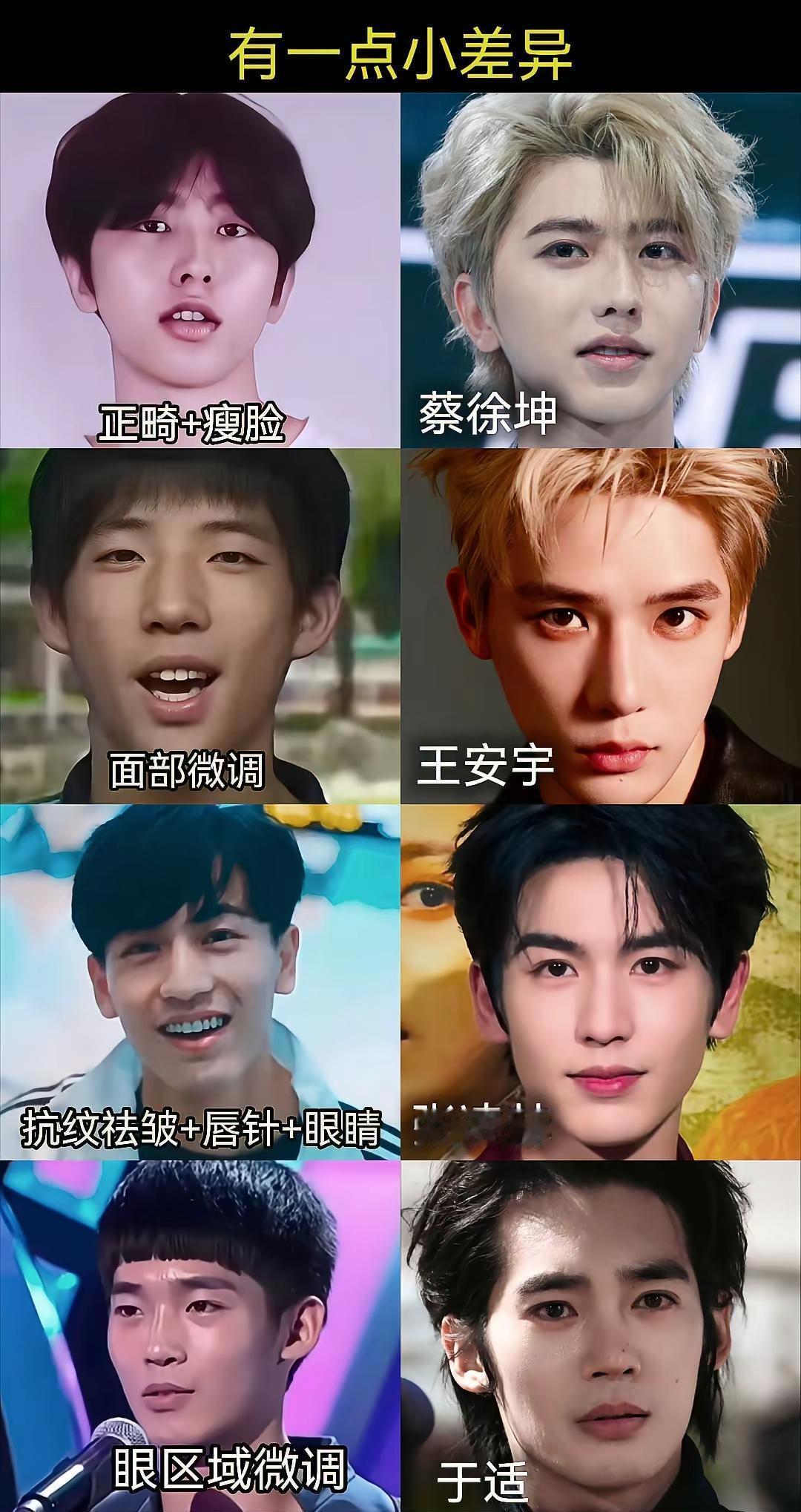 你以为蔡徐坤的帅脸纯靠基因？他每年在医美上砸的钱，够买一套房。90%的艺人悄