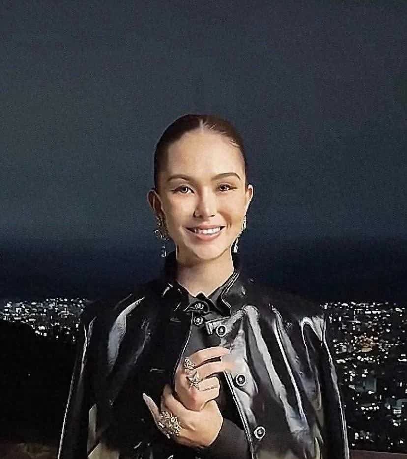 昆凌出席某活动，发际线高了很多，脸部也是有点僵硬，医美过度了