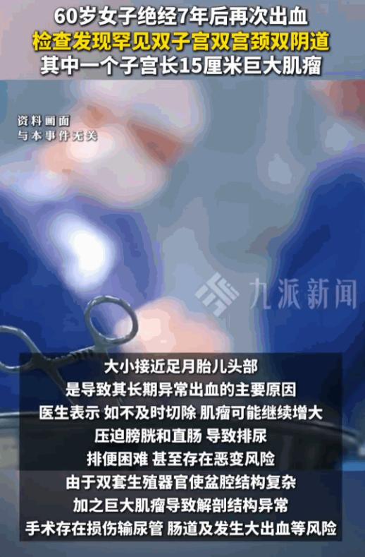 广东的刘阿姨今年60岁，绝经都已经整整七年了。按理说，到了这个岁数，女人跟妇科那