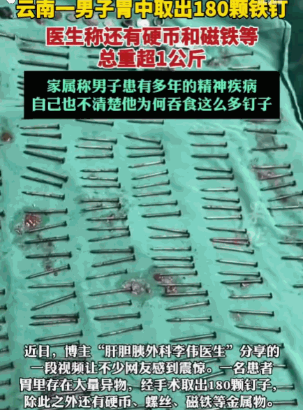 云南，一男子肚子疼紧急就医，检查结果吓坏医生，他肚子里面有着足足两斤尖锐金属。