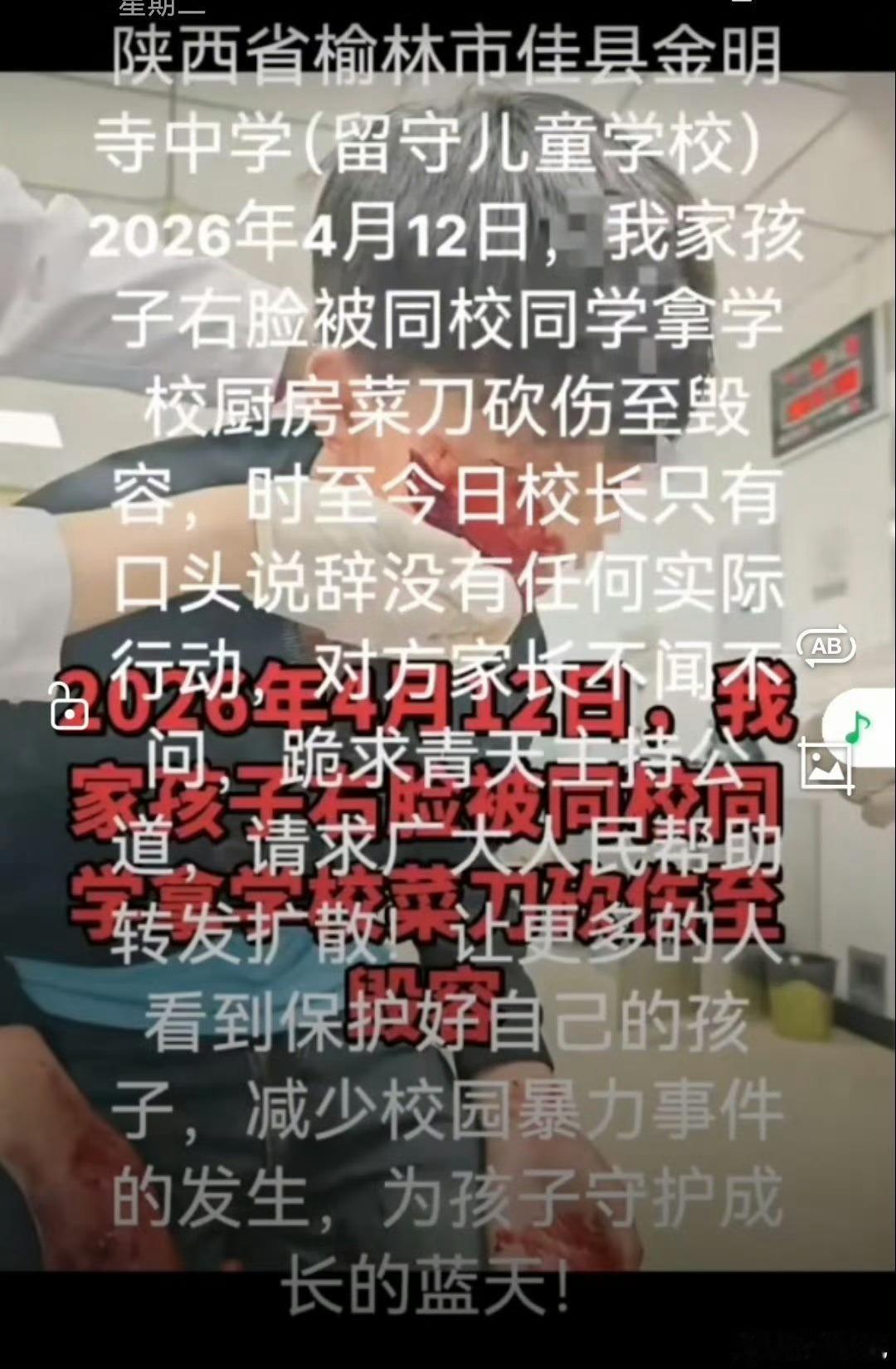 榆林身边事佳县金明寺中学发生菜刀伤人事件：校园安全防线为何失守？据网络平台网