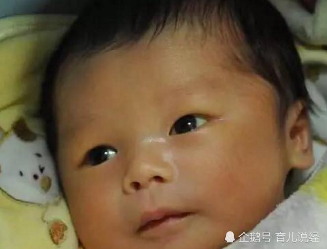 医生朋友看到妈妈晒的宝宝照片 发现宝宝的问题 最后才能及时治疗