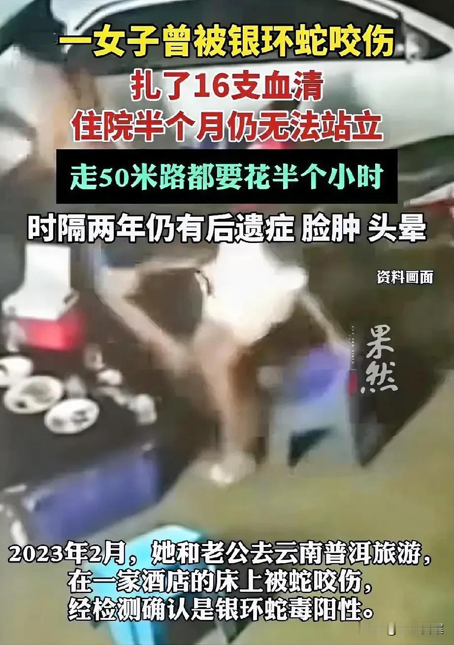 银环蛇真的太毒了[哭哭]！一女子2年前去云南普洱旅游，夜晚躺酒店床上被银环蛇