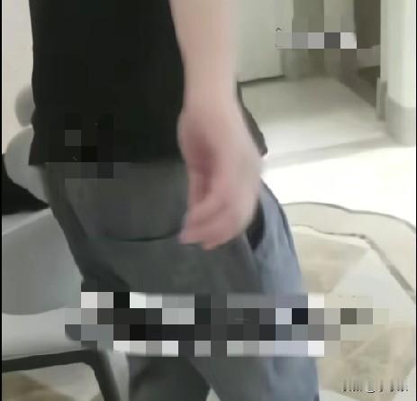 河南郑州一男子之前痛风发作过1次，但尿酸值一直在600左右，自己觉着不疼，以为身