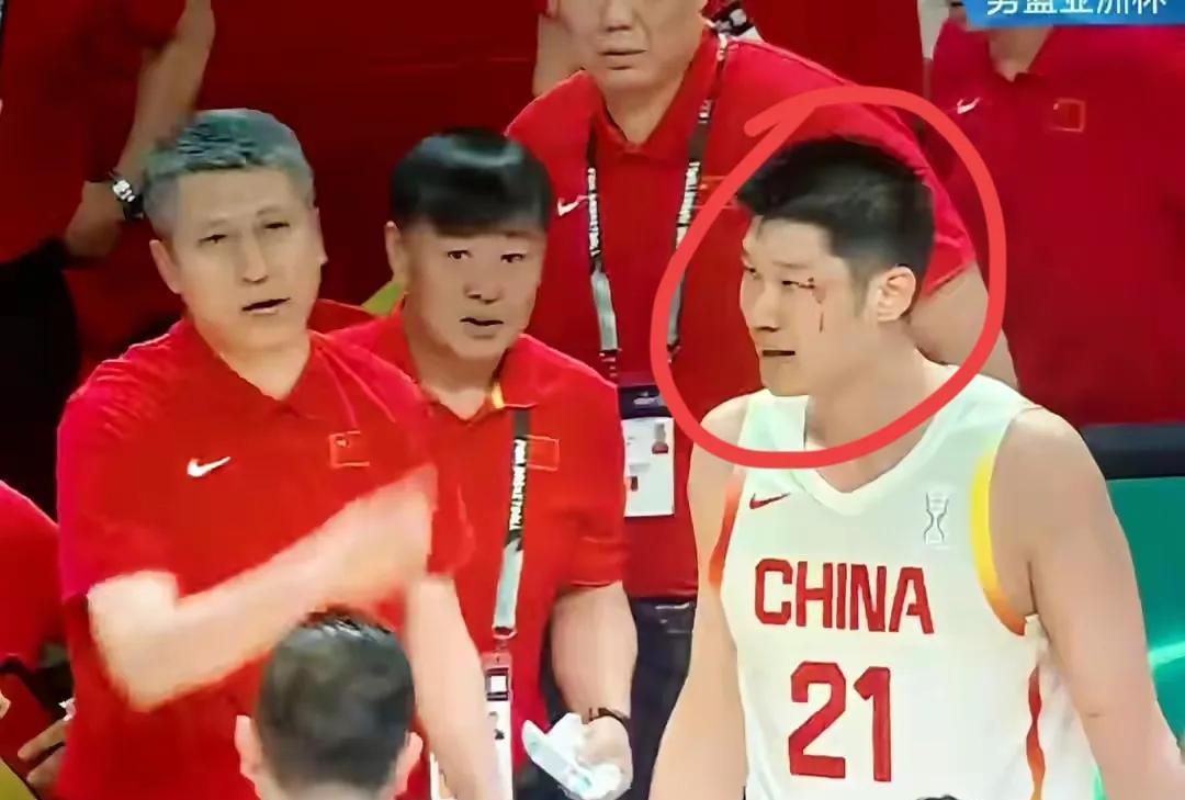 心疼胡金秋！胡金秋左眼角挂彩，赛后面对记者采访时，他说:“这没事，都是小事，对