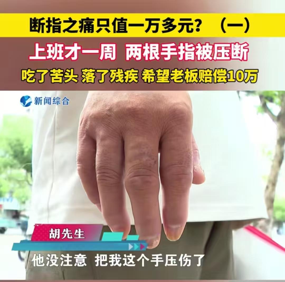 浙江桐乡，男子找了一份工作，结果才上班一周，老板操作不当，把他的两只手指给压断了
