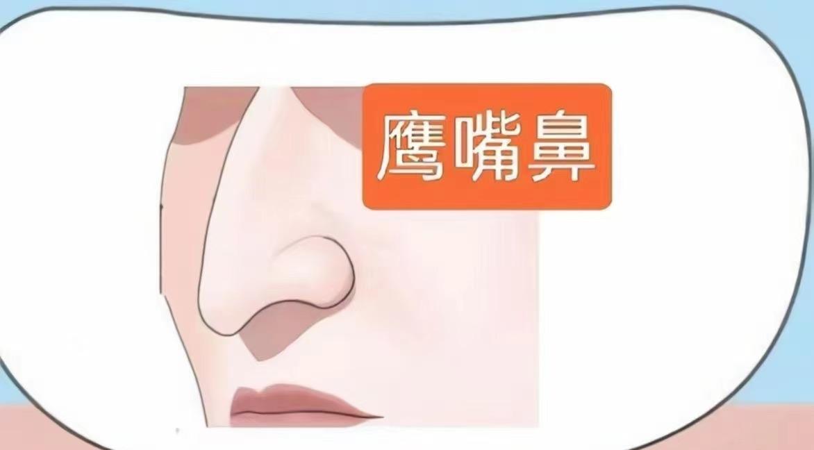 面相风水知识分享——鹰钩鼻