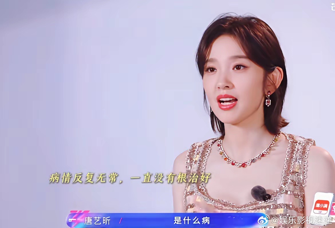 4月4日，唐艺昕公开感谢张若昀！在她因容貌问题无法拍戏的这4年里，在她反复询问张