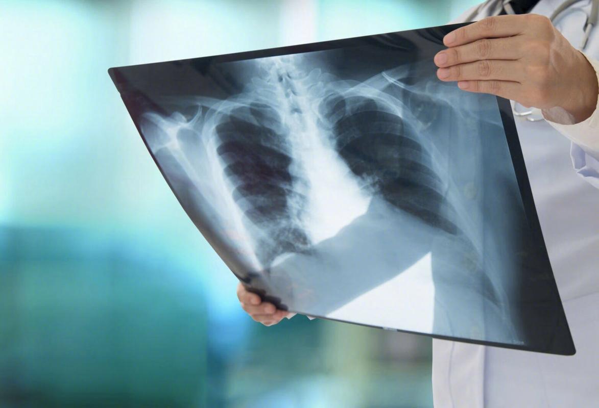 肺部有疾，脸会说话，如果脸上没有这3种异常，说明肺还算健康如果脸可以说话，它