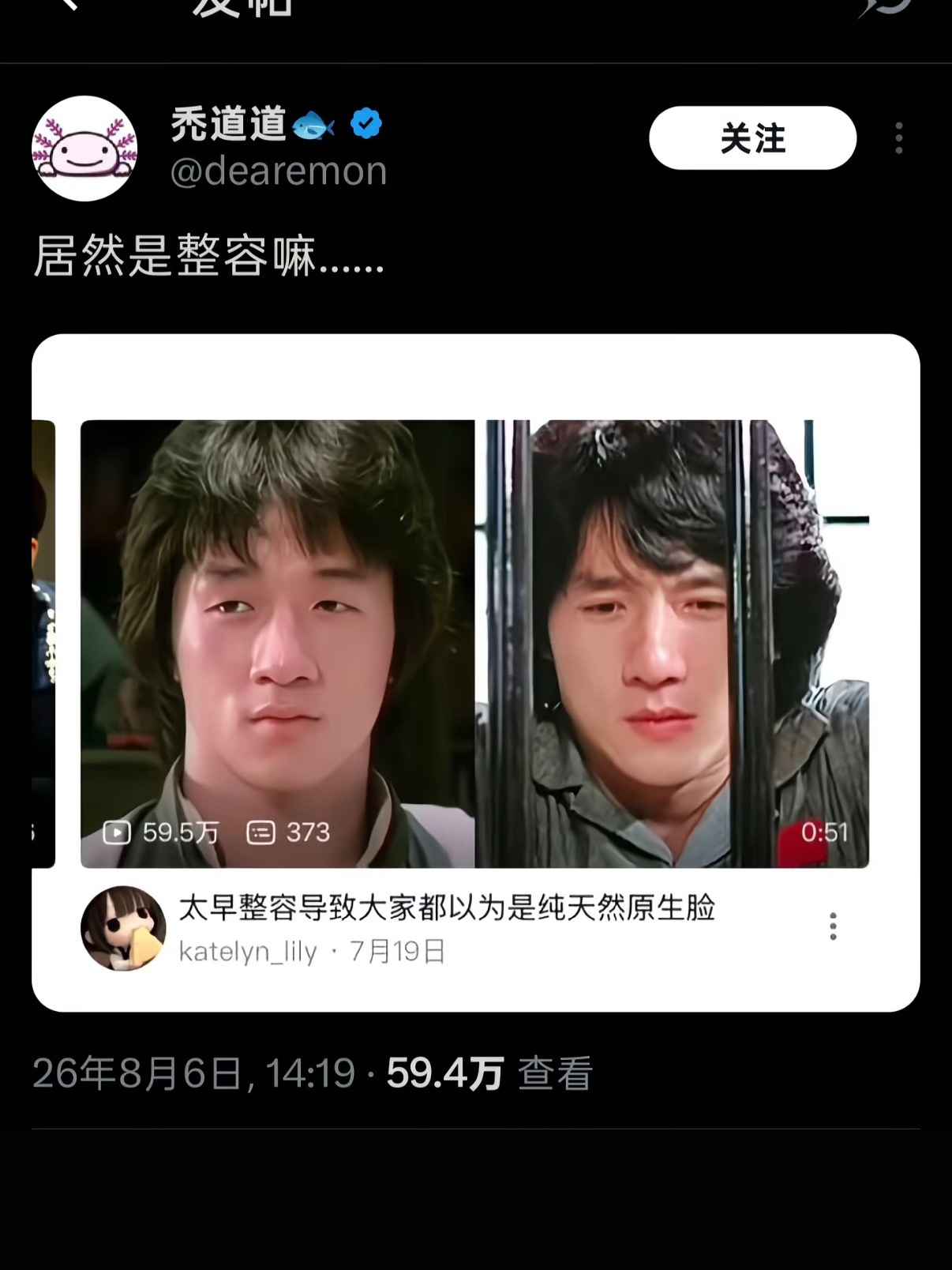 成龙居然整过容吗