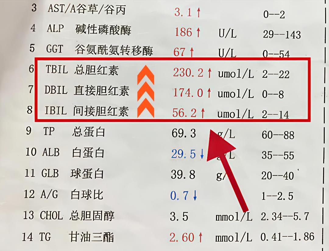 今天门诊接诊一位40多岁的患者，一来就说自己眼睛发黄、浑身没劲。肝功能...