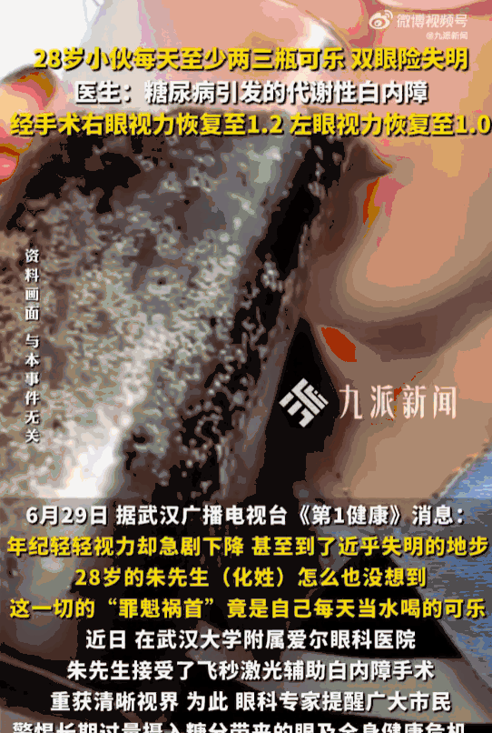 惨痛教训！湖北武汉，一名28岁男子一夜之间双眼近乎失明，医生检查后发现：罪魁祸首