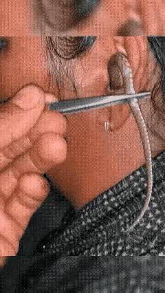 大姐睡得真沉。入梦后，一条小蛇钻进了姐姐的耳朵里，因为蛇长了鳞片，钻入狭小的空