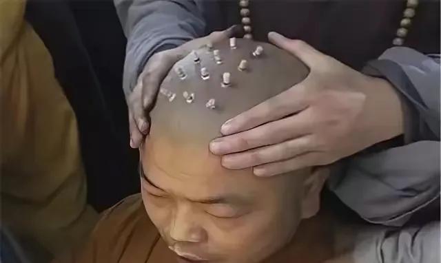 有很多网友说和尚要恢复烫戒疤，能接受这种痛苦的人才是真心想入佛门的人，不然进去了