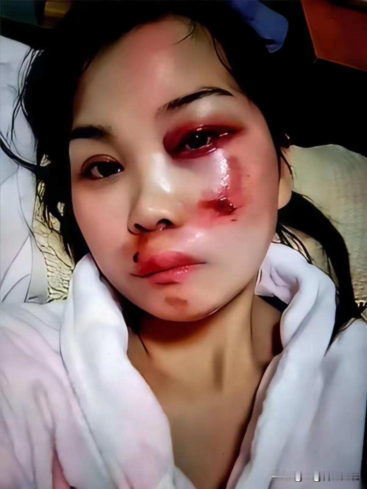 湖北襄阳的刘女士，这是要搬起石头砸自己的脚吗？她公开发布了一个被家暴的视频，播