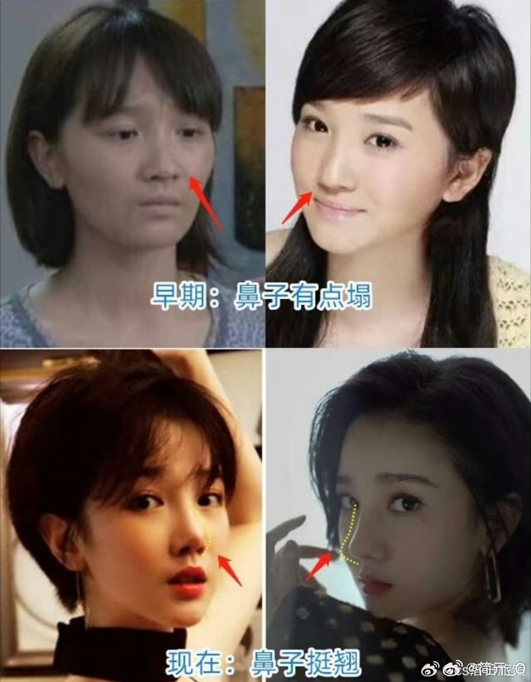 #陈小纭整骨#可是我觉得早期更好看[爱心]​