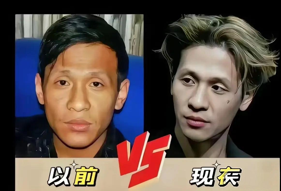 听说宋小宝整容了，我有点不相信。完全看不出来是谁了。