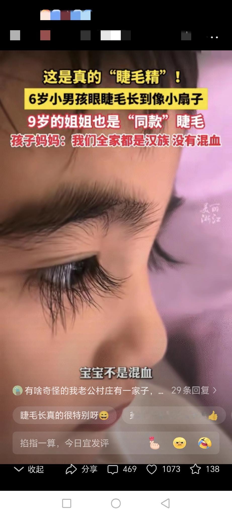 江西夫妻“零混血”却生出两枚“洋娃娃”？别急着喊颜色，基因这张彩票远比你想象