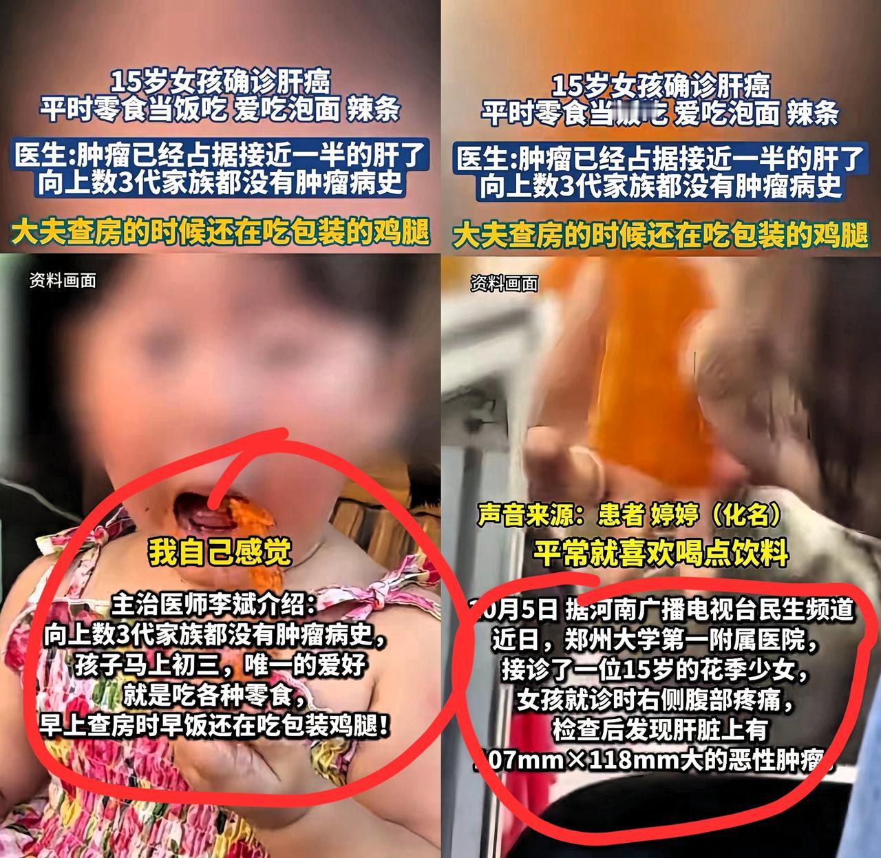 都是零食惹的祸！15岁的花季少女被确诊为肝癌，医生一了解情况都叹气——这哪是生