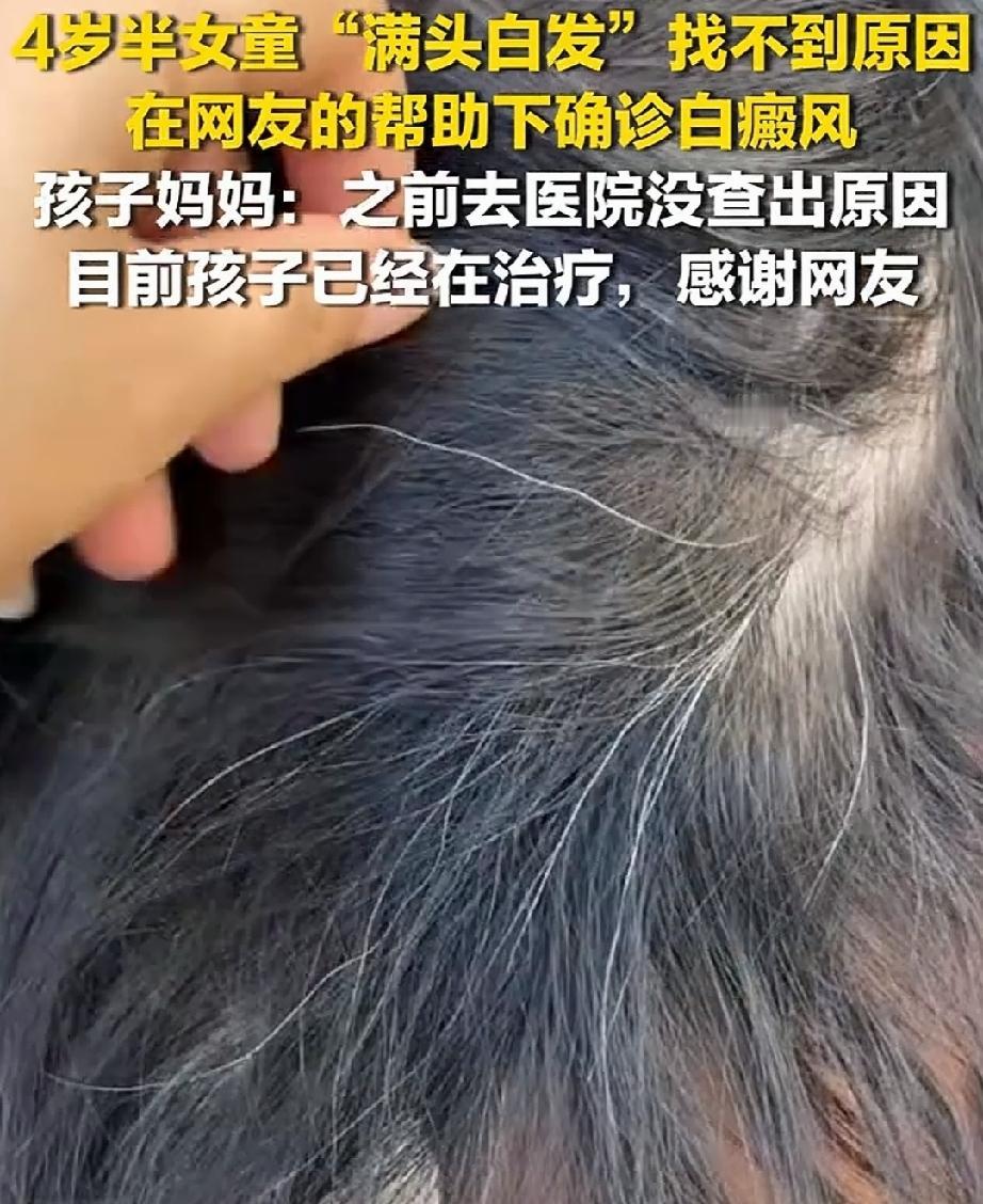近日，贵州毕节。4岁的女童头上开始长出白发，而且越长越多。妈妈杨女士带着孩子去医