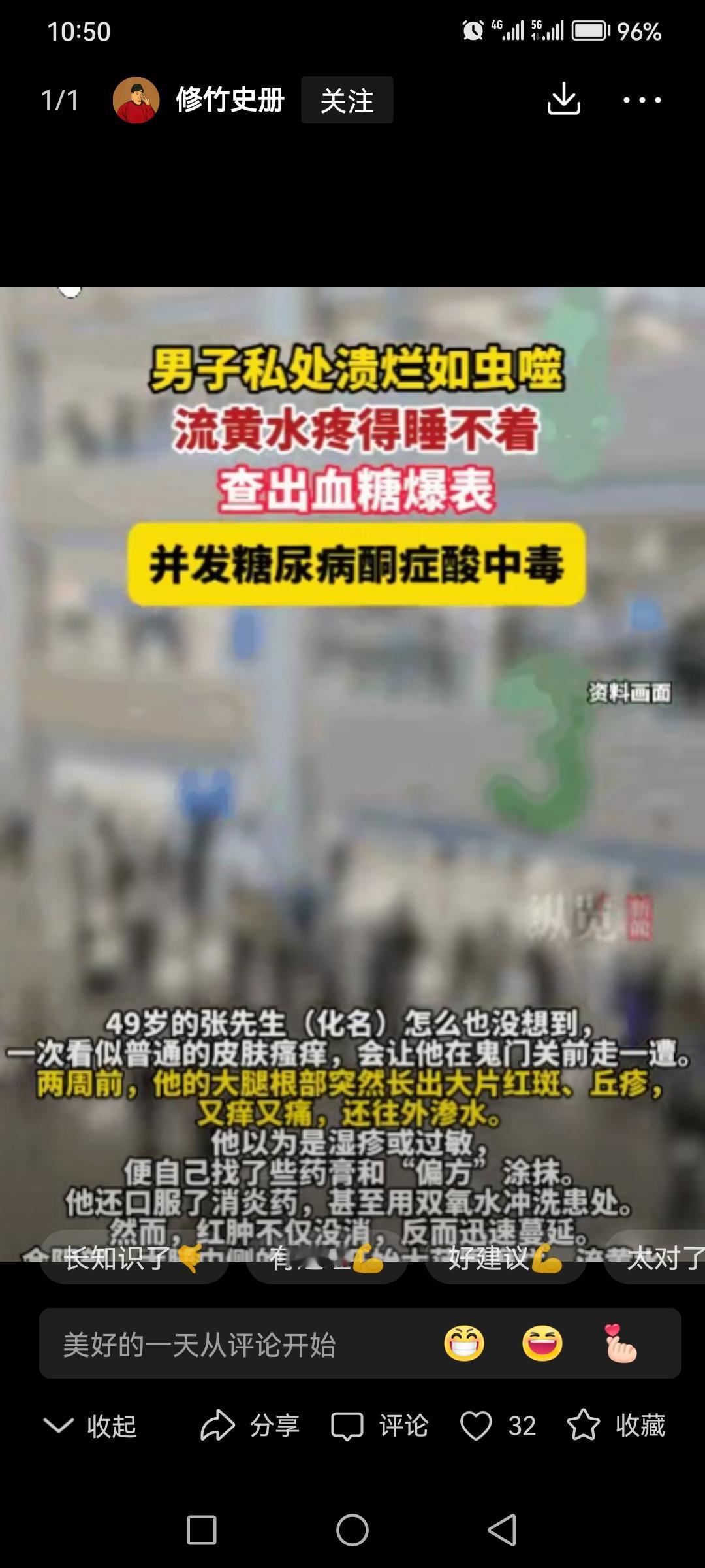 太大意了！深圳，一49岁的男子大腿根突发红斑丘疹，又痒又痛。他误以为是湿疹，自行