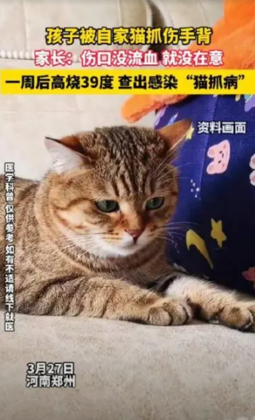 畜生永远都是畜生！”河南郑州，一小孩和自家猫在一块玩耍时，不小心被抓伤，因伤口没