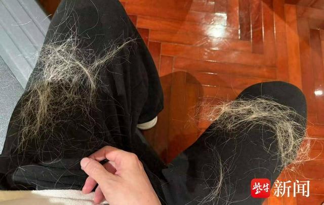 薛之谦“满头斑秃水疱”上热搜! 医生建议, 一年染发别超过4次