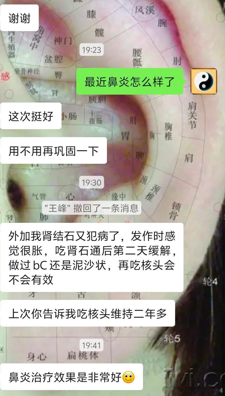 最近鼻炎效果不错。天气凉了鼻炎复发的不少打喷嚏流鼻涕，鼻子痒，小孩子清嗓子，吸鼻