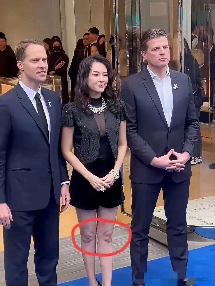 中间的章子怡膝盖是怎么回事？