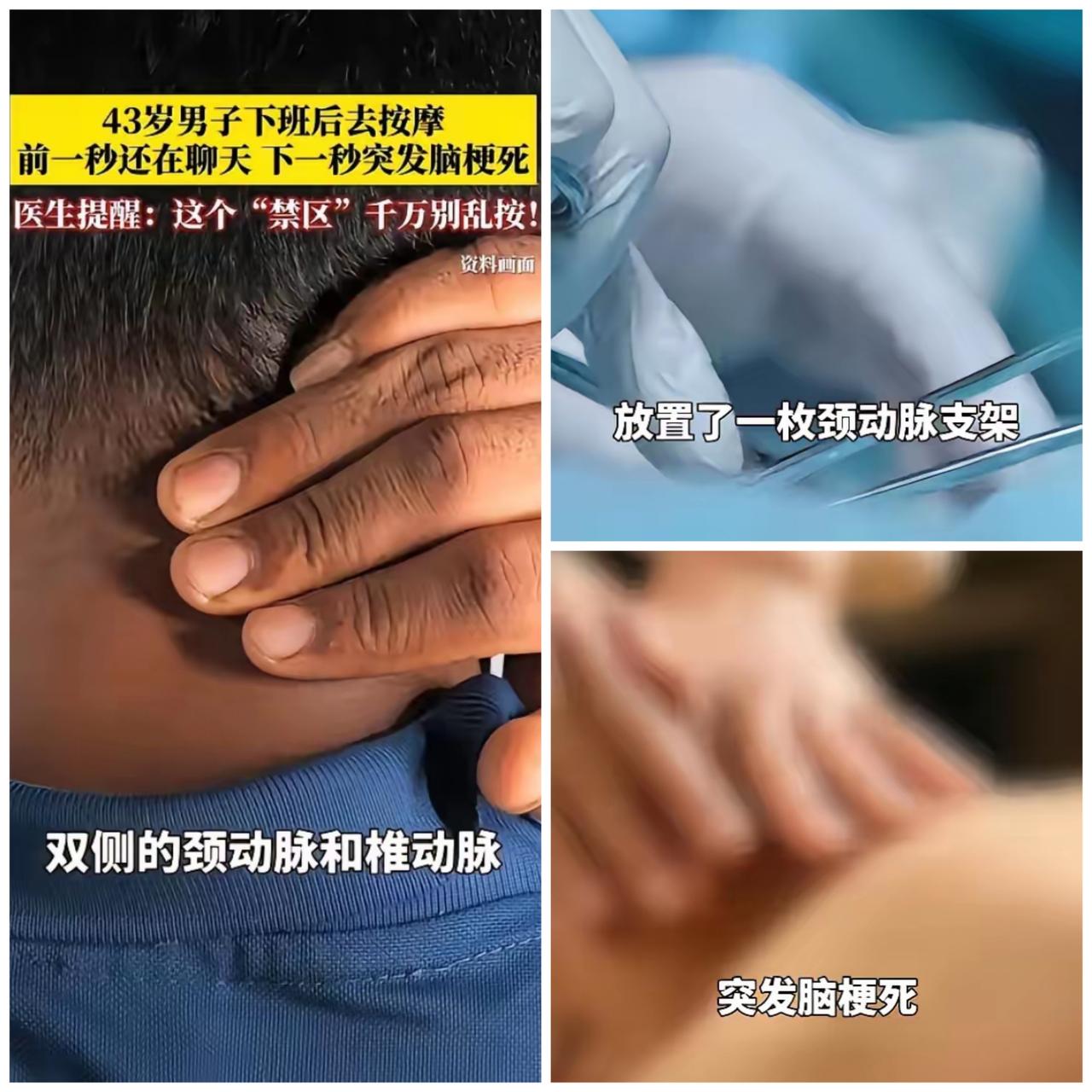 别再乱按脖子了！真的会按出脑梗，太多人还在犯错。太吓人了！河南一位43岁男子，就