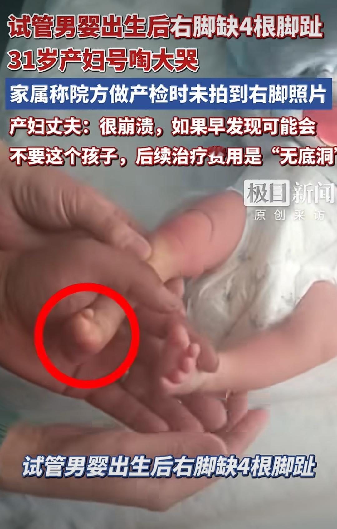 山东滨州一对夫妻因为女方输卵管的问题，结婚后一直没能自然怀孕，后来在滨州医学院附