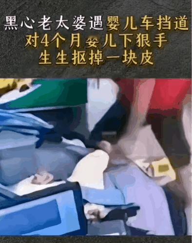 超市里，一个4个月大的婴儿突然大哭起来，妈妈过去看看，发现宝宝的脚上被抠掉了一大