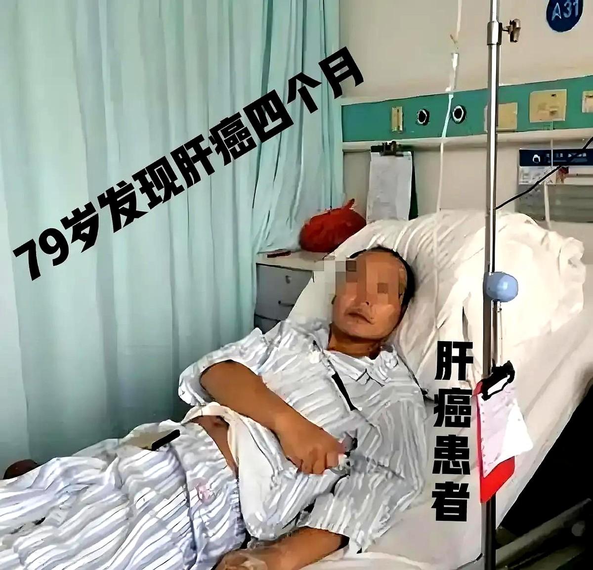 紧急求助民间中医，肝癌患者，医院检查确诊，已经4个月。男♂️，79岁，肝区疼