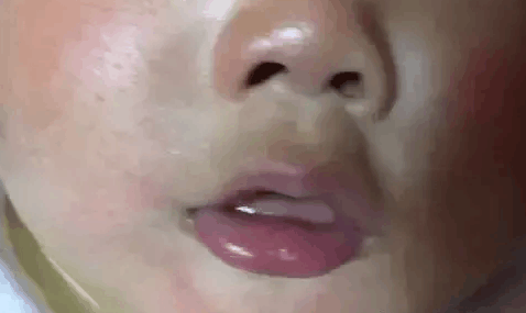 宝宝最常见的7种皮肤问题, 实拍图教你认~