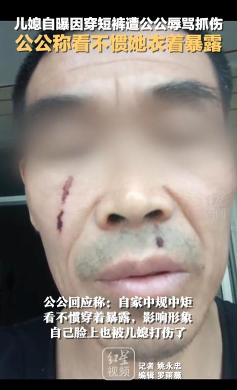 天气炎热在家穿条短裤避暑，在很多年轻人眼里是再平常不过的小事，可四川内江一名女子