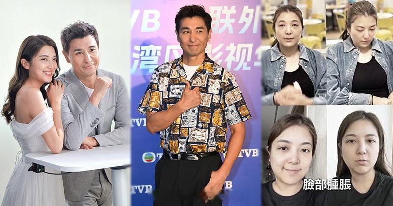 明报：称老婆单文柔感染过滤性病毒陈展鹏体检报告佳：可以再生小朋友电视广播有限公