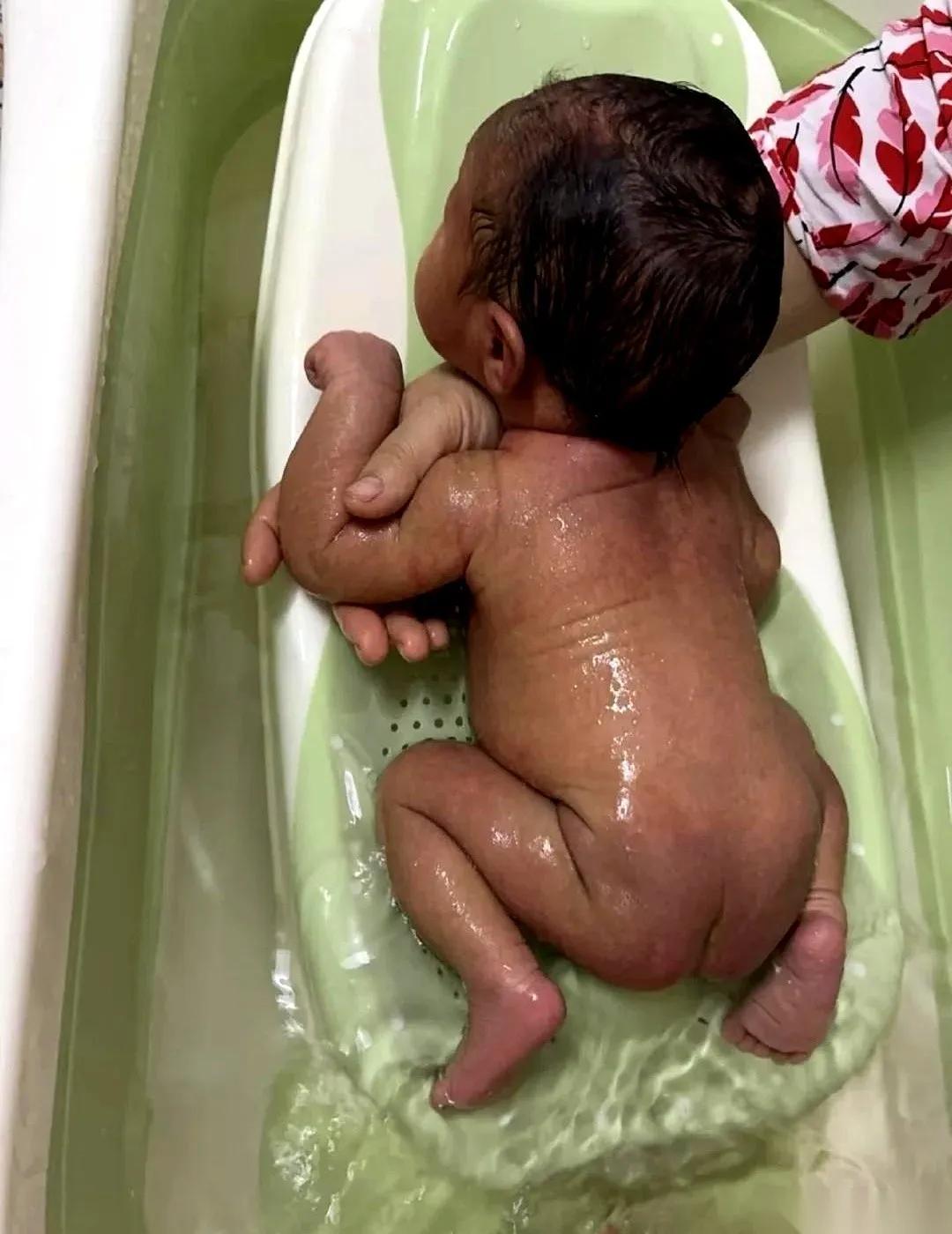 婴儿喂养误区大揭秘,6个月宝宝肠坏死不是个例!经常听到有家长说:我担心我家宝宝