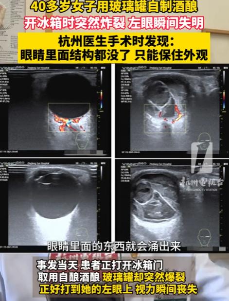 “太吓人了！”近日，浙江，一女子在家用玻璃罐自制酒酿，随后放进冰箱保存，